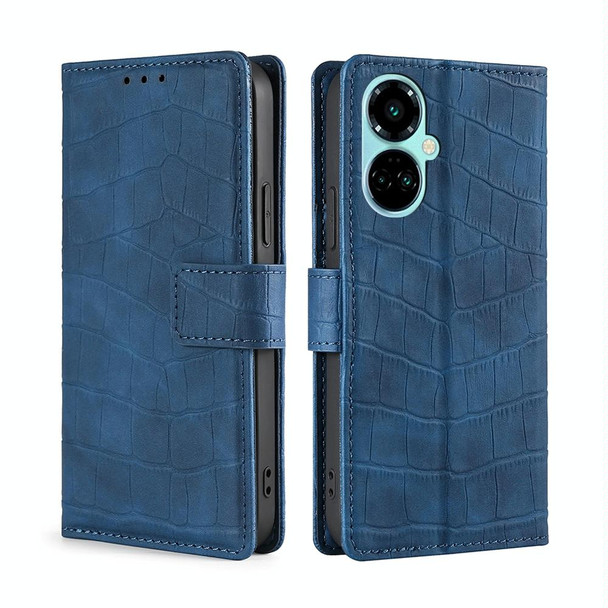 For Tecno Camon 19 / 19 Pro Skin Feel Crocodile Magnetic Clasp Leatherette Phone Case(Blue)