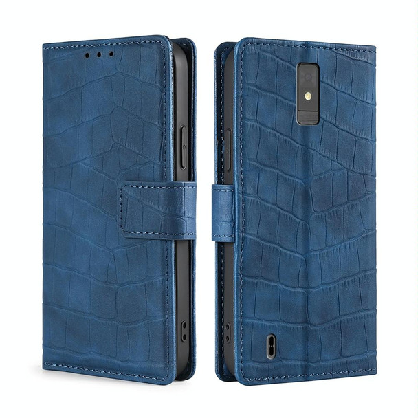 For ZTE Blade A32 Skin Feel Crocodile Magnetic Clasp Leather Phone Case(Blue)