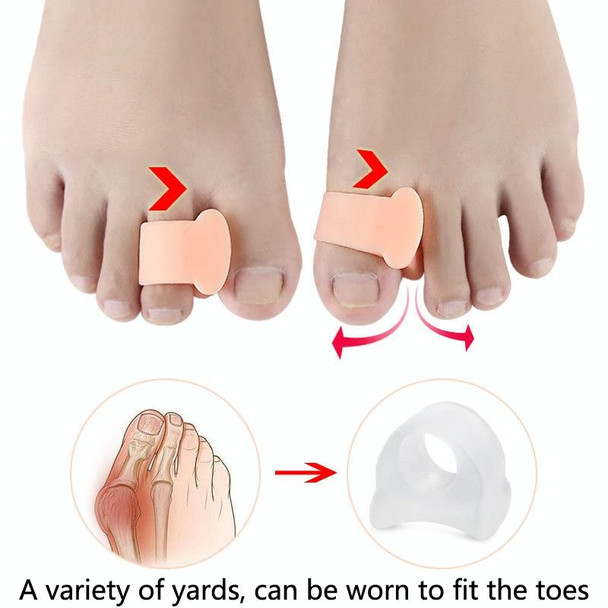 10 Pairs Great Toe Orthosis Separator Soft and Comfortable Toe Care Cover, Size: M(Brighten Skin Color)