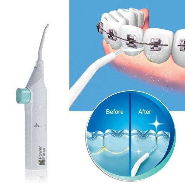 Dental Hygiene Oral Irrigator Dental Floss Oral Power Water Jet Pick Cleaning Irrigator Tooth Mouth Denture Cleaner Care, Pack:OPP bag