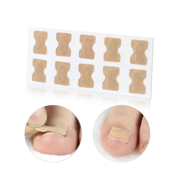 10 PCS Glue-free Orthopedic Nail Stick Toe Nail Groove Inlay Corrector(Blue Bottom )