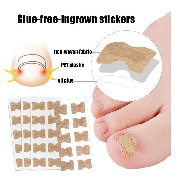 10 PCS Glue-free Orthopedic Nail Stick Toe Nail Groove Inlay Corrector(White Bottom )