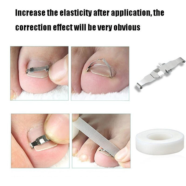 Orthopedic Buckle Toe Nail Groove Ingrown Nail Corrector, Style:No. 38, Specifications:Positive Nail Buckle