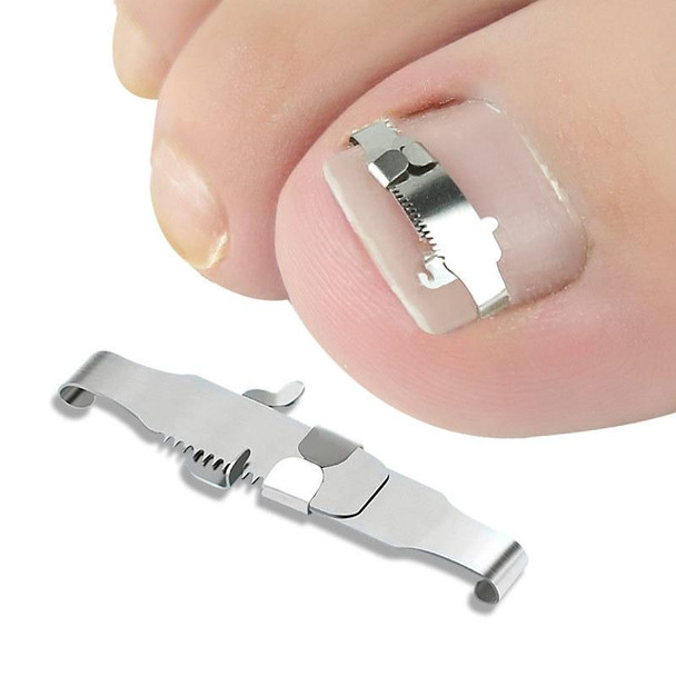 Orthopedic Buckle Toe Nail Groove Ingrown Nail Corrector, Style:No. 42, Specifications:Positive Nail Buckle