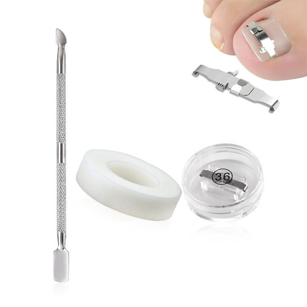 Orthopedic Buckle Toe Nail Groove Ingrown Nail Corrector, Style:No. 40, Specifications:Set