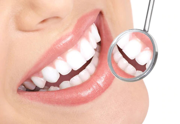 20 Minute Dental Teeth Whitening Kit