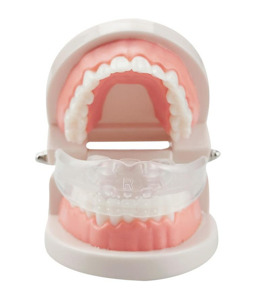 Orthodontic Appliance Silicone Simulation Braces Anti-molar Braces for Night(The third stage)