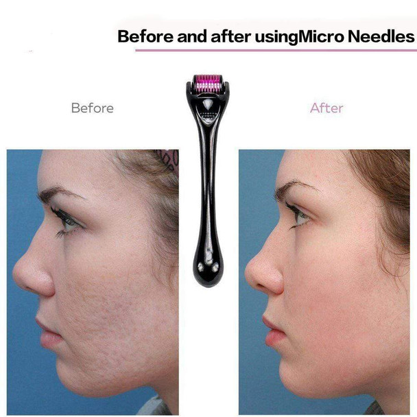 microneedle-derma-roller-snatcher-online-shopping-south-africa-17782534275231.jpg