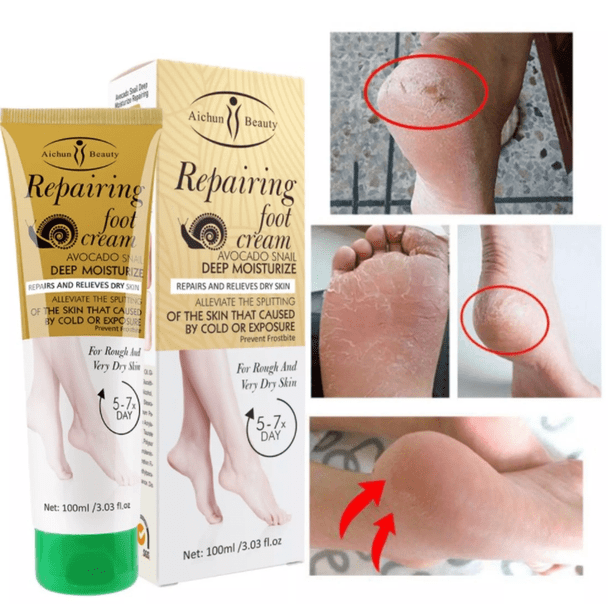 repairing-foot-cream-snatcher-online-shopping-south-africa-29051870019743.png