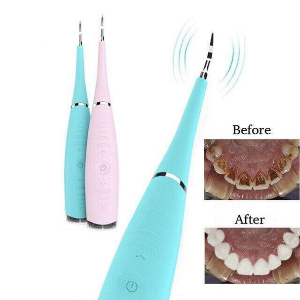2-in-1-dental-scaler-and-facial-cleanser-snatcher-online-shopping-south-africa-29858109685919.jpg