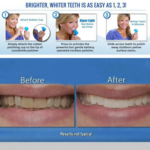 Whitening & Polishing Teeth Kit