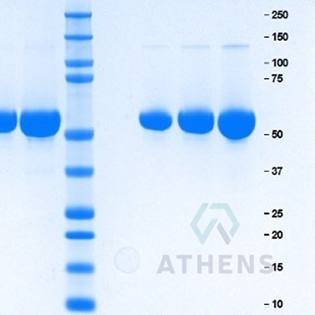 SDS-PAGE Gels - Alpha 1 Antitrypsin