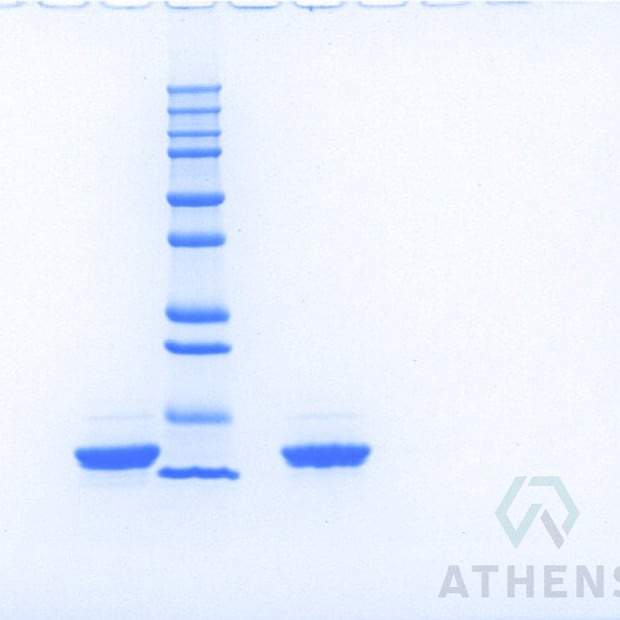 SDS-PAGE Gels - Apolipoprotein CIII