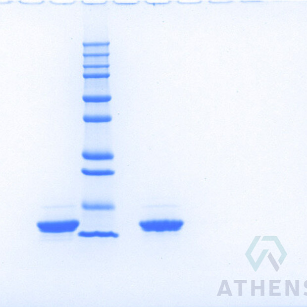 SDS-PAGE Gels - Apolipoprotein CIII (Lyophilized)