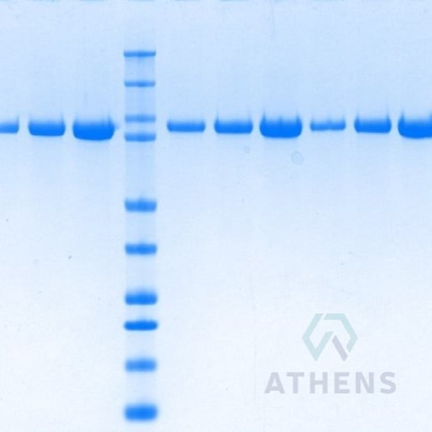 SDS-PAGE Gels - C1 Esterase Inhibitor