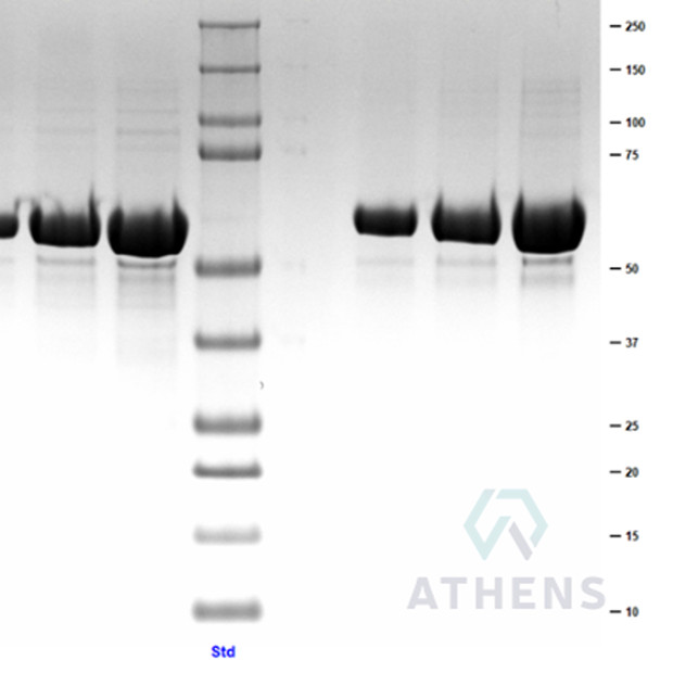 SDS-PAGE Gels - Catalase