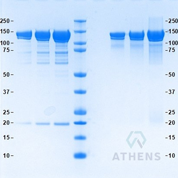SDS-PAGE Gels - Ceruloplasmin