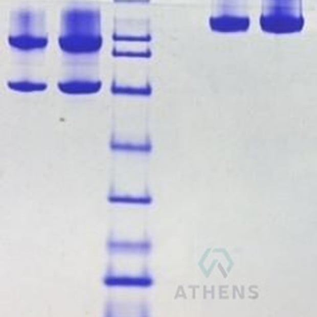 SDS-PAGE Gels - Complement C5