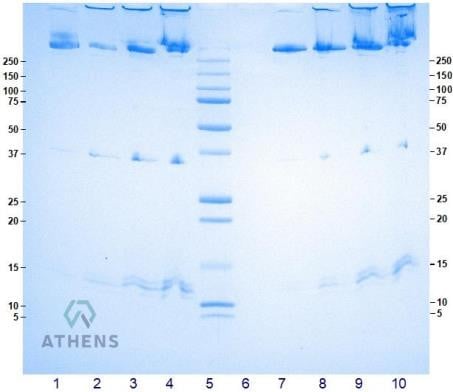 SDS-PAGE Gels - Lipoproteins, Intermediate Density