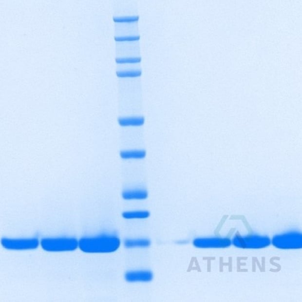 SDS-PAGE Gels - Lysozyme