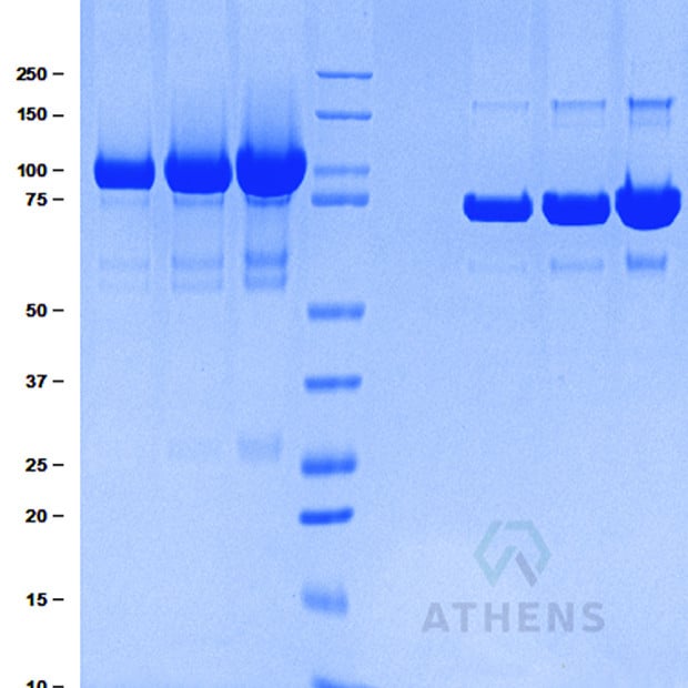 SDS-PAGE Gels - Plasmin (Frozen)