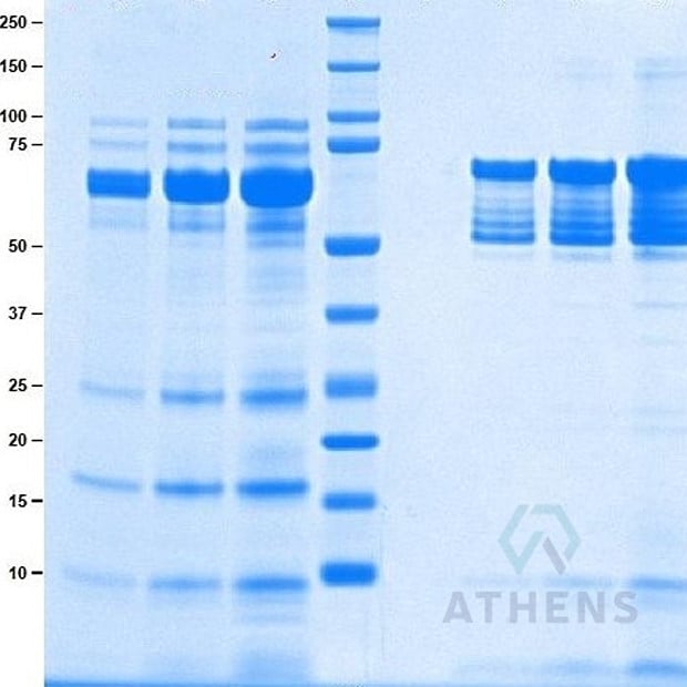 SDS-PAGE Gels - Plasmin (Lyophilized)