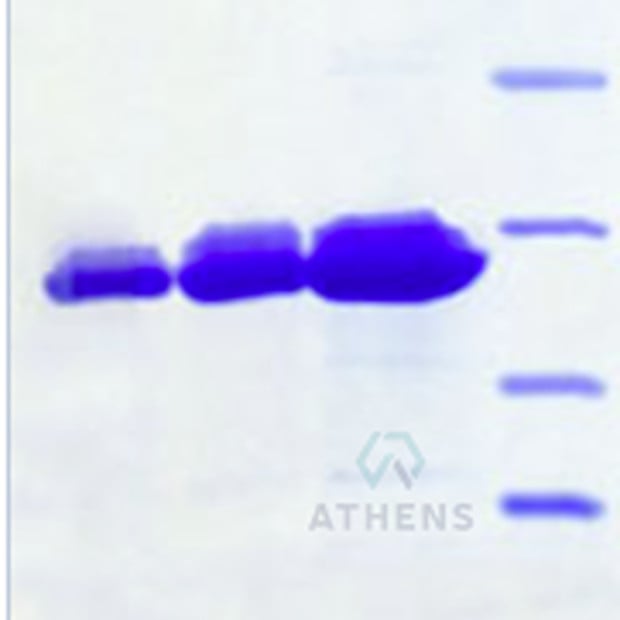 SDS-PAGE Gels - Proteinase 3