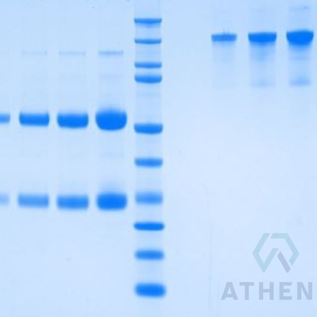 SDS-PAGE Gels - Immunoglobulin G, Rat