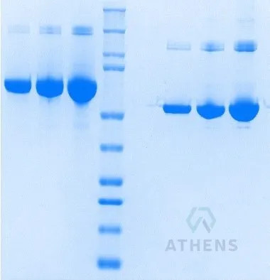 SDS-PAGE Gel