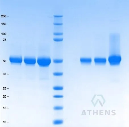 SDS-PAGE Gel
