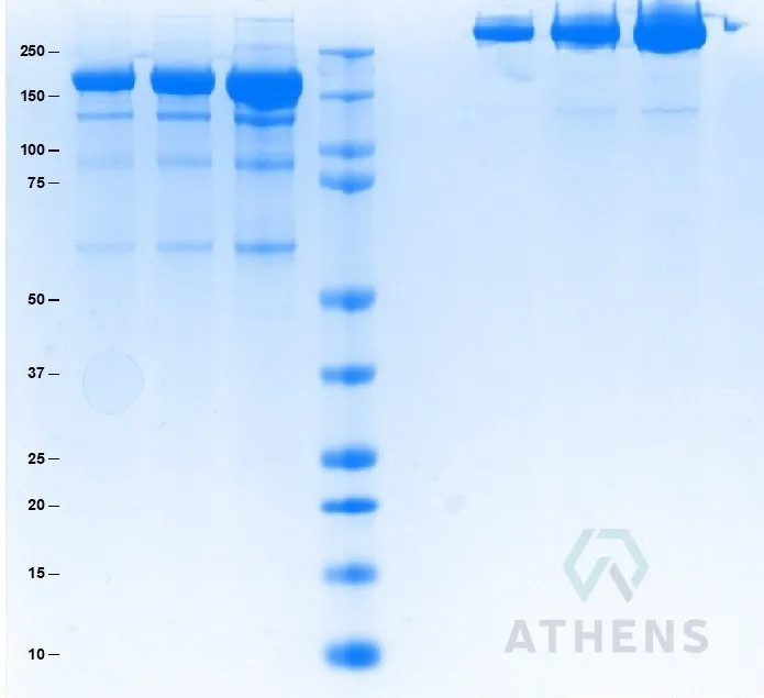 SDS-PAGE Gel
