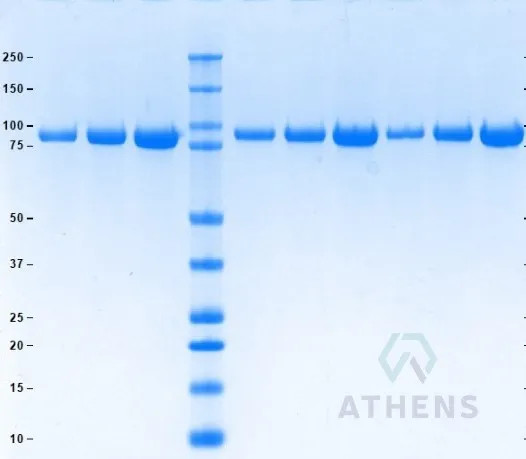 SDS-PAGE Gel