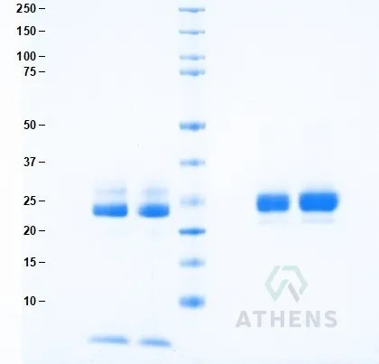 SDS-PAGE Gel