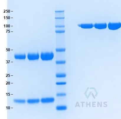SDS-PAGE Gel