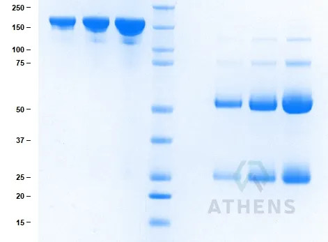SDS-PAGE Gel