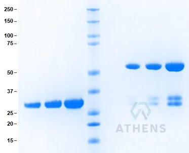 SDS-PAGE Gel