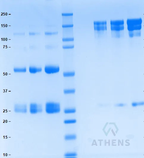 SDS-PAGE Gel