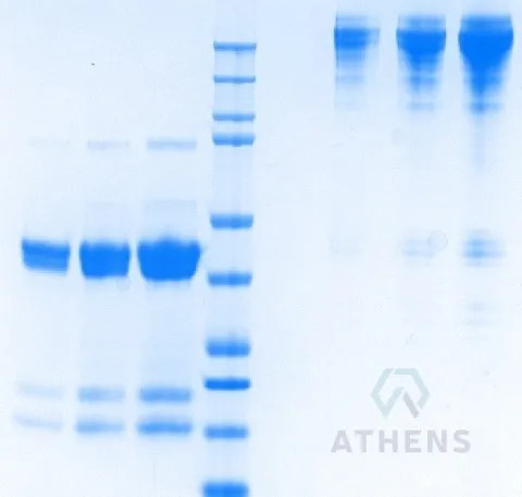 SDS-PAGE Gel