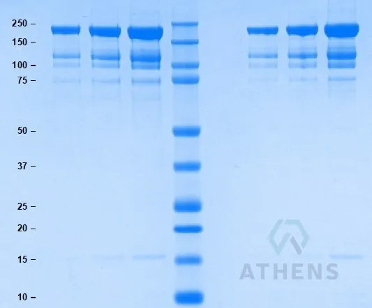 SDS-PAGE Gel