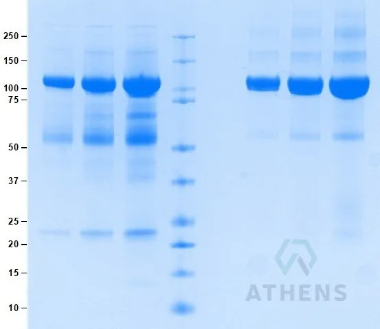 SDS-PAGE Gel