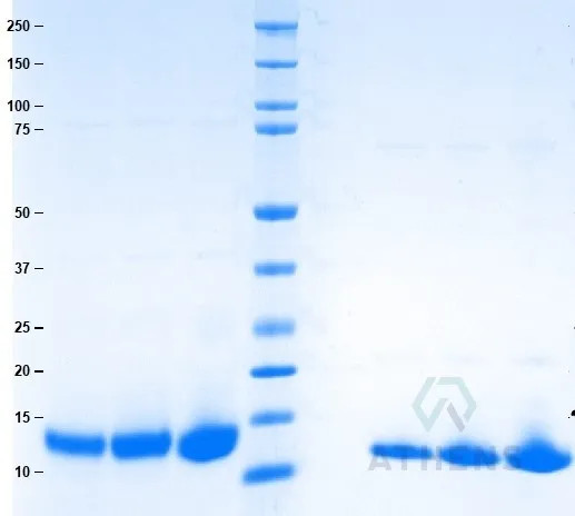 SDS-PAGE Gel