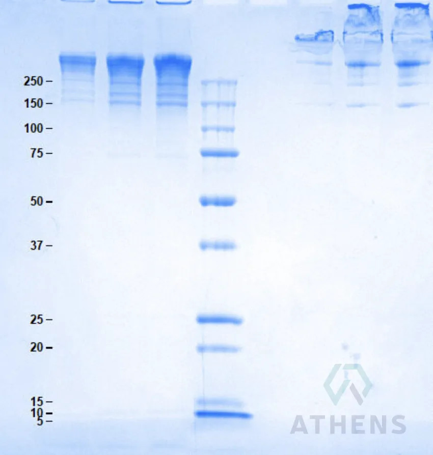 SDS-PAGE Gel