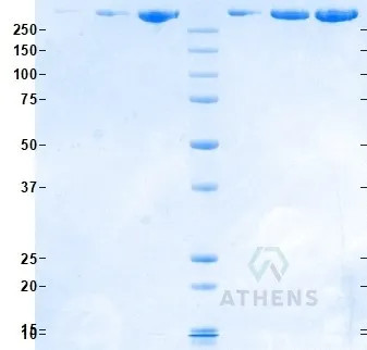 SDS-PAGE Gel