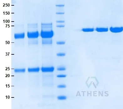 SDS-PAGE Gel