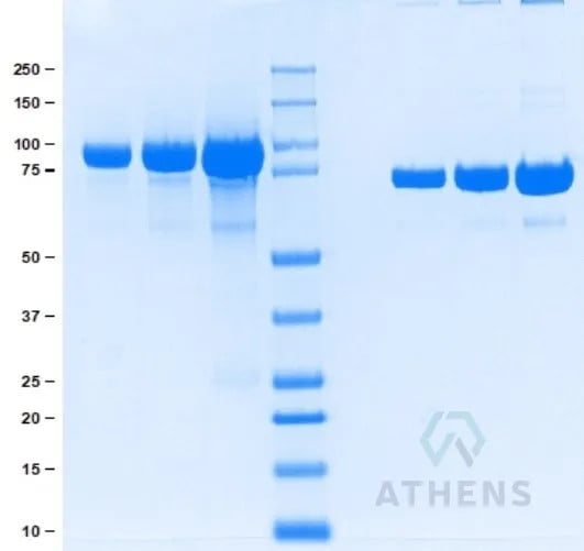 SDS-PAGE Gel
