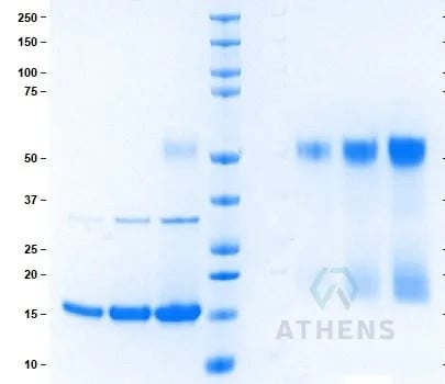 SDS-PAGE Gel