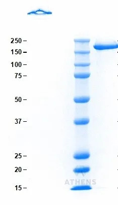 SDS-PAGE Gel