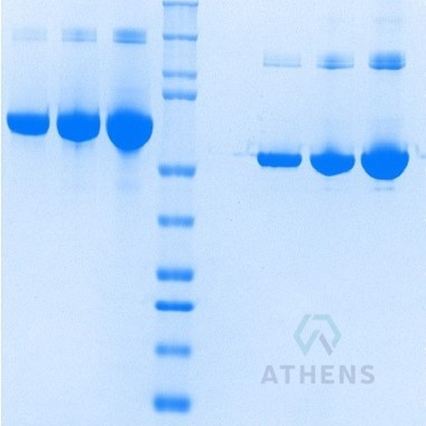 SDS-PAGE Gels - Albumin