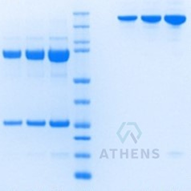 SDS-PAGE Gels - Immunoglobulin E