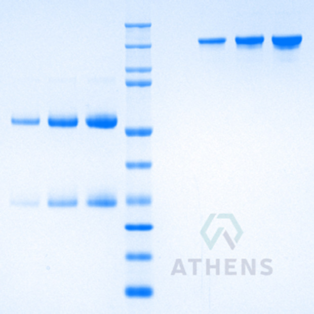 SDS-PAGE Gels - Immunoglobulin G1